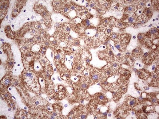 LRRC6 Antibody in Immunohistochemistry (Paraffin) (IHC (P))