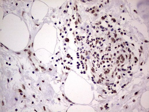 LPIN1 Antibody in Immunohistochemistry (Paraffin) (IHC (P))