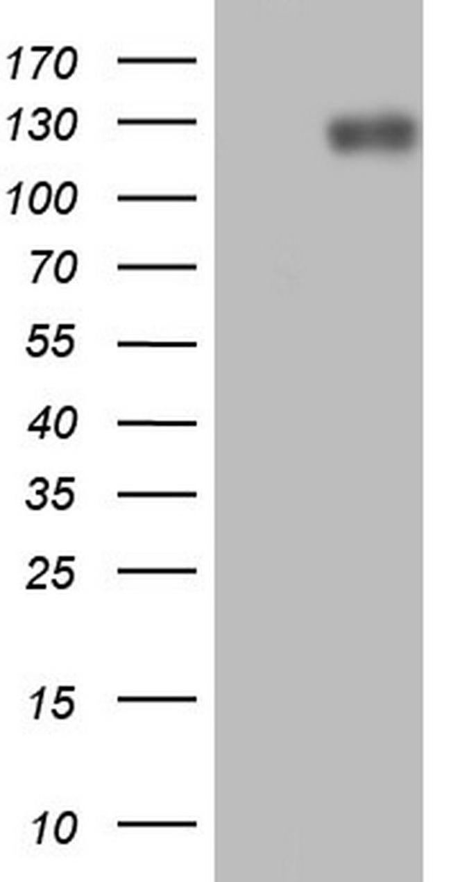 LPIN1 Antibody in Western Blot (WB)