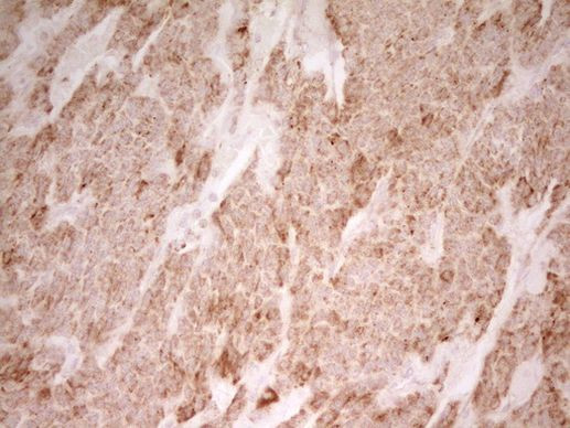 MRRF Antibody in Immunohistochemistry (Paraffin) (IHC (P))