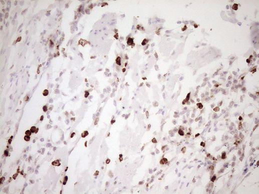 TFPI Antibody in Immunohistochemistry (Paraffin) (IHC (P))