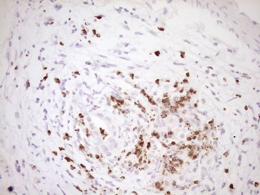 TFPI Antibody in Immunohistochemistry (Paraffin) (IHC (P))