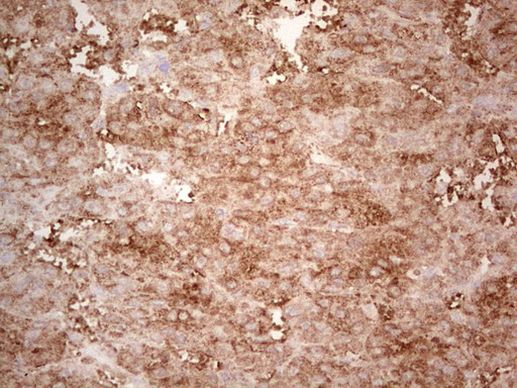 Ephrin A3 Antibody in Immunohistochemistry (Paraffin) (IHC (P))