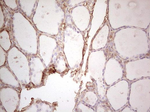 Ephrin A3 Antibody in Immunohistochemistry (Paraffin) (IHC (P))