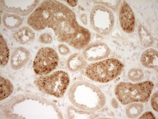 TFPI Antibody in Immunohistochemistry (Paraffin) (IHC (P))