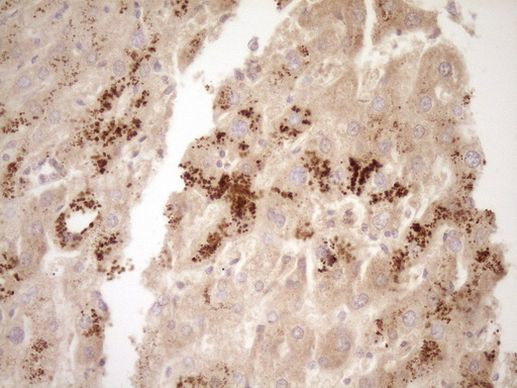 TFPI Antibody in Immunohistochemistry (Paraffin) (IHC (P))