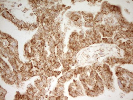 MRRF Antibody in Immunohistochemistry (Paraffin) (IHC (P))