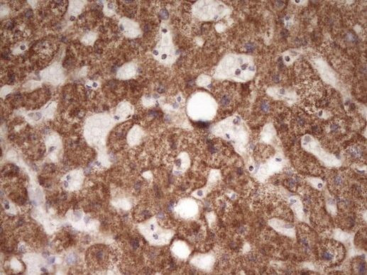 LRRC6 Antibody in Immunohistochemistry (Paraffin) (IHC (P))