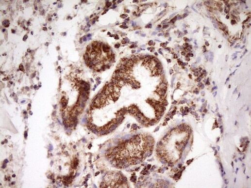 LRRC6 Antibody in Immunohistochemistry (Paraffin) (IHC (P))