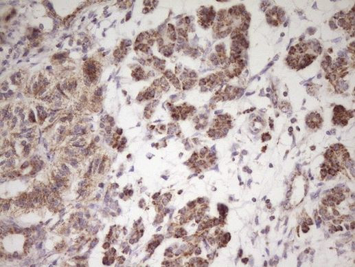 LRRC6 Antibody in Immunohistochemistry (Paraffin) (IHC (P))