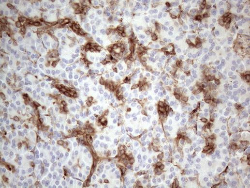 LPIN1 Antibody in Immunohistochemistry (Paraffin) (IHC (P))