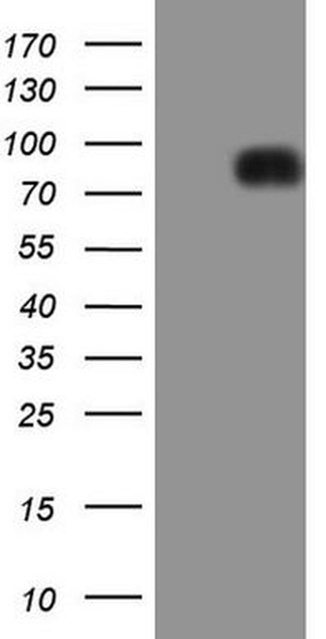 LPIN1 Antibody in Western Blot (WB)