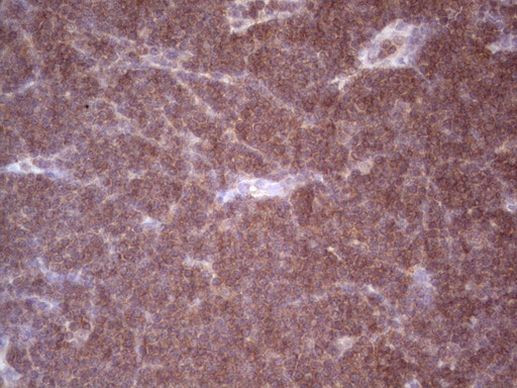 Angiopoietin 2 Antibody in Immunohistochemistry (Paraffin) (IHC (P))