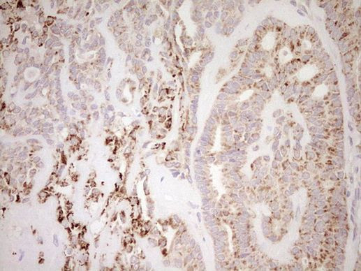 NR0B2 Antibody in Immunohistochemistry (Paraffin) (IHC (P))