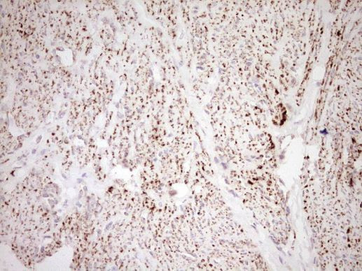 NR0B2 Antibody in Immunohistochemistry (Paraffin) (IHC (P))