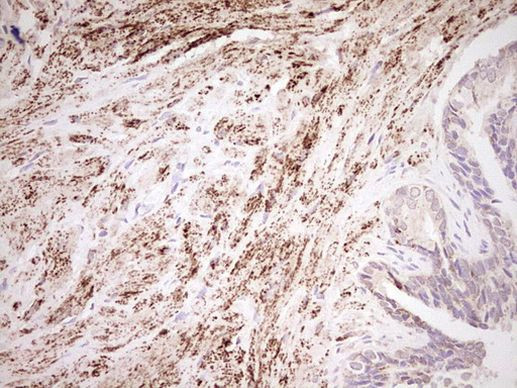 NR0B2 Antibody in Immunohistochemistry (Paraffin) (IHC (P))