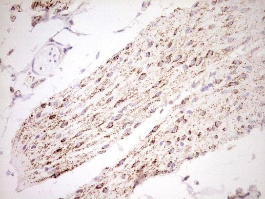 NR0B2 Antibody in Immunohistochemistry (Paraffin) (IHC (P))