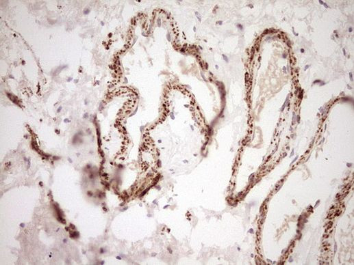 NR0B2 Antibody in Immunohistochemistry (Paraffin) (IHC (P))