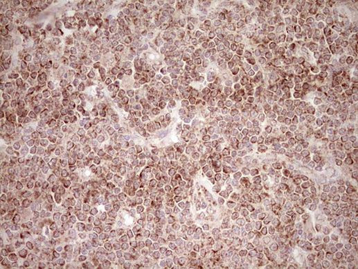 NR0B2 Antibody in Immunohistochemistry (Paraffin) (IHC (P))