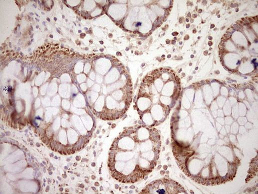 NR0B2 Antibody in Immunohistochemistry (Paraffin) (IHC (P))