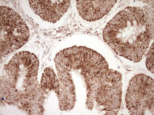 NR0B2 Antibody in Immunohistochemistry (Paraffin) (IHC (P))