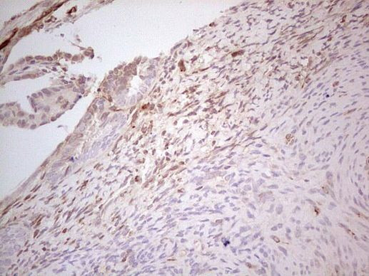 MGP Antibody in Immunohistochemistry (Paraffin) (IHC (P))