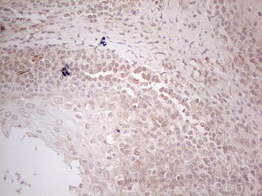 MGP Antibody in Immunohistochemistry (Paraffin) (IHC (P))