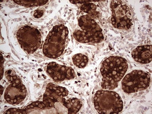 MGP Antibody in Immunohistochemistry (Paraffin) (IHC (P))