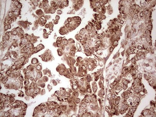 WIBG Antibody in Immunohistochemistry (Paraffin) (IHC (P))