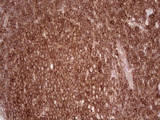 WIBG Antibody in Immunohistochemistry (Paraffin) (IHC (P))