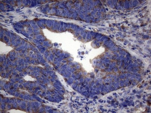 NARS2 Antibody in Immunohistochemistry (Paraffin) (IHC (P))