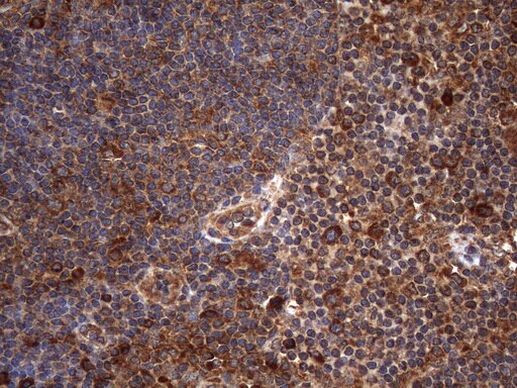 NARS2 Antibody in Immunohistochemistry (Paraffin) (IHC (P))