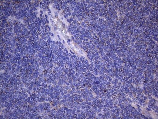 NARS2 Antibody in Immunohistochemistry (Paraffin) (IHC (P))