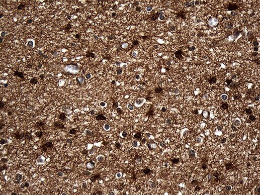 DCLK1 Antibody in Immunohistochemistry (Paraffin) (IHC (P))