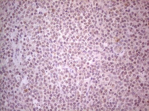 GABRA5 Antibody in Immunohistochemistry (Paraffin) (IHC (P))