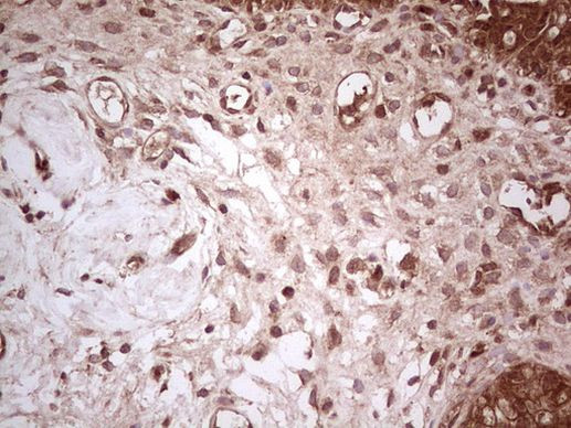 UBE2D2 Antibody in Immunohistochemistry (Paraffin) (IHC (P))