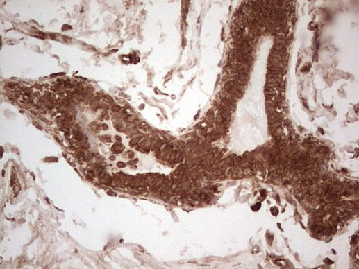 UBE2D2 Antibody in Immunohistochemistry (Paraffin) (IHC (P))