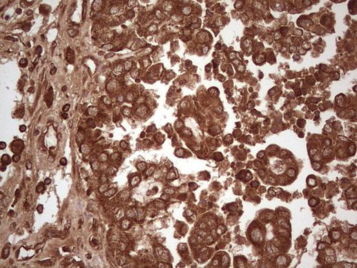 UBE2D2 Antibody in Immunohistochemistry (Paraffin) (IHC (P))