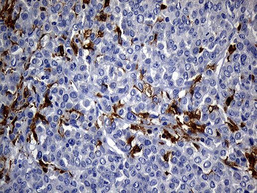 UBE3B Antibody in Immunohistochemistry (Paraffin) (IHC (P))