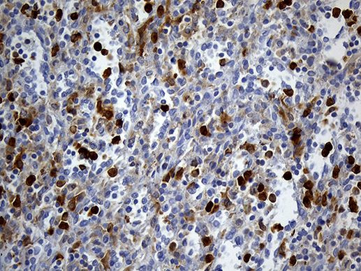 UBE3B Antibody in Immunohistochemistry (Paraffin) (IHC (P))