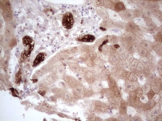 PHGDH Antibody in Immunohistochemistry (Paraffin) (IHC (P))