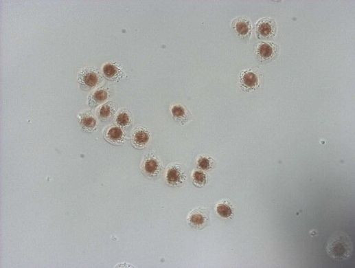 NUDT21 Antibody in Immunocytochemistry (ICC/IF)