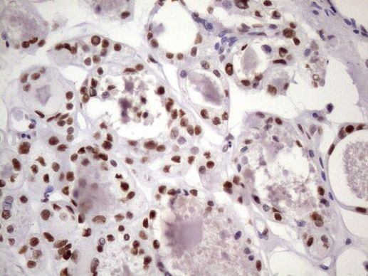 NUDT21 Antibody in Immunohistochemistry (Paraffin) (IHC (P))