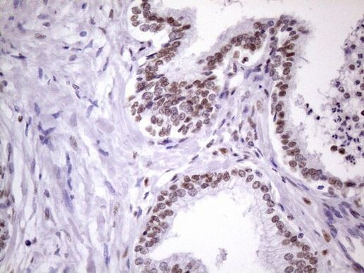 NUDT21 Antibody in Immunohistochemistry (Paraffin) (IHC (P))