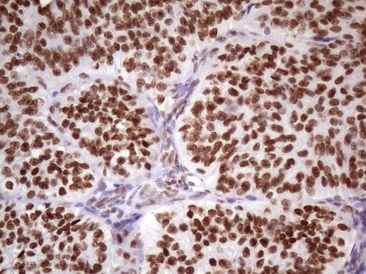 NUDT21 Antibody in Immunohistochemistry (Paraffin) (IHC (P))