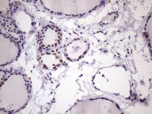 NUDT21 Antibody in Immunohistochemistry (Paraffin) (IHC (P))