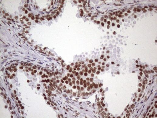 NUDT21 Antibody in Immunohistochemistry (Paraffin) (IHC (P))