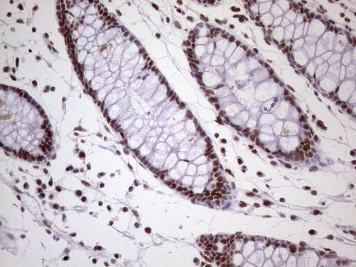 NUDT21 Antibody in Immunohistochemistry (Paraffin) (IHC (P))