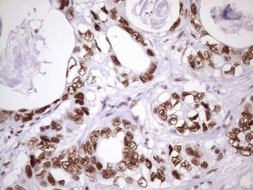 NUDT21 Antibody in Immunohistochemistry (Paraffin) (IHC (P))