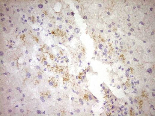 CTGF Antibody in Immunohistochemistry (Paraffin) (IHC (P))